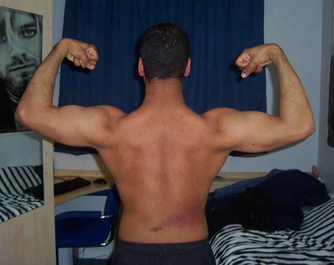 back biceps