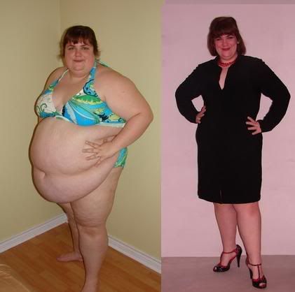 beforeandafter2years-1.jpg picture by BabyRhi