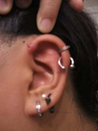 Is an industrial post to leave a cartilage "bump" like that?