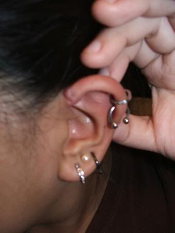 Is an industrial post to leave a cartilage "bump" like that?