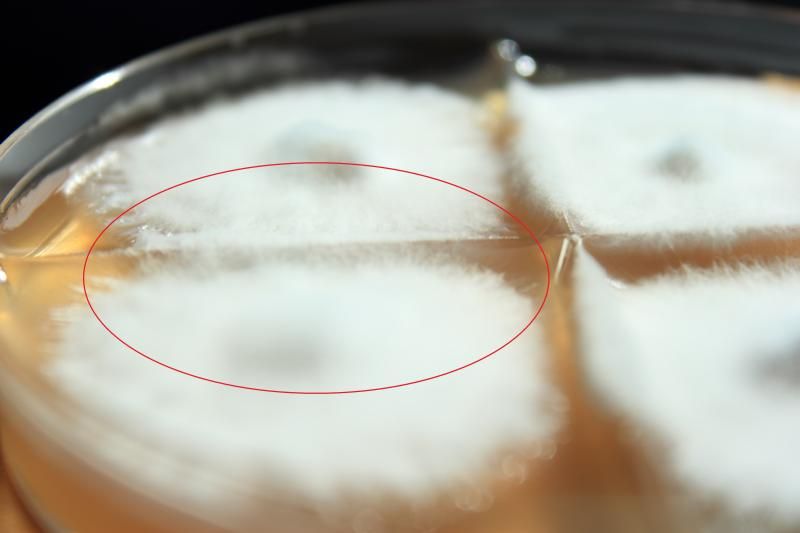 Reading agar plates, Educate me. Advanced Mycology Shroomery