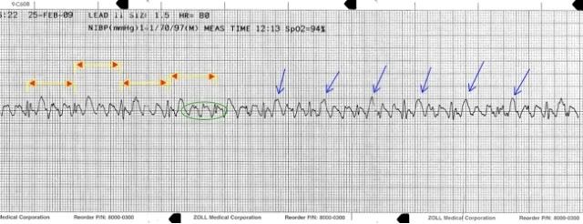 EKG2-1.jpg