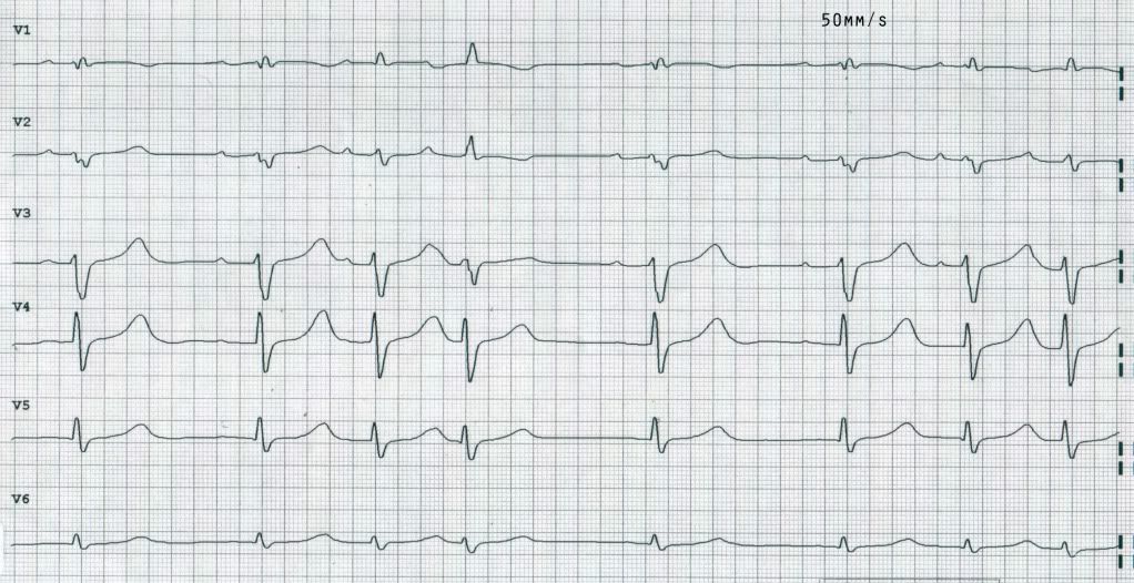 EKG2-2.jpg