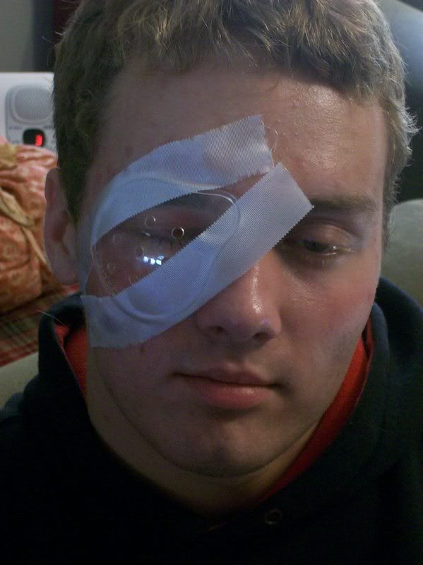 Shot in the eye with a paintball gun...... Honda TRX 450R